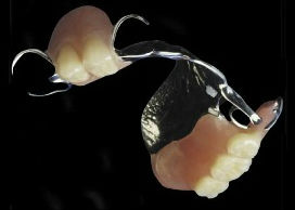 photo-of-partial-dentures-appliance
